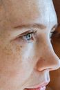 Woman with freckles on blue eyes