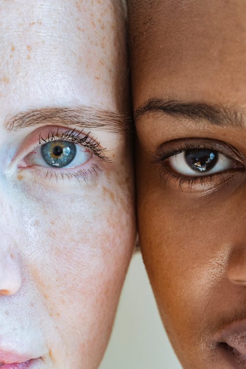 Free Woman with freckled face near black model Stock Photo