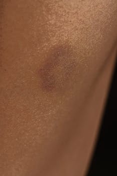 Closeup of crop unrecognizable ethnic person with fleck on soft brown and beige body skin