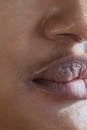Closeup of crop anonymous ethnic person with sensitive lips and blackheads on oily skin with shadow