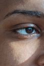 Crop black model with brown eye and shadow on cheek