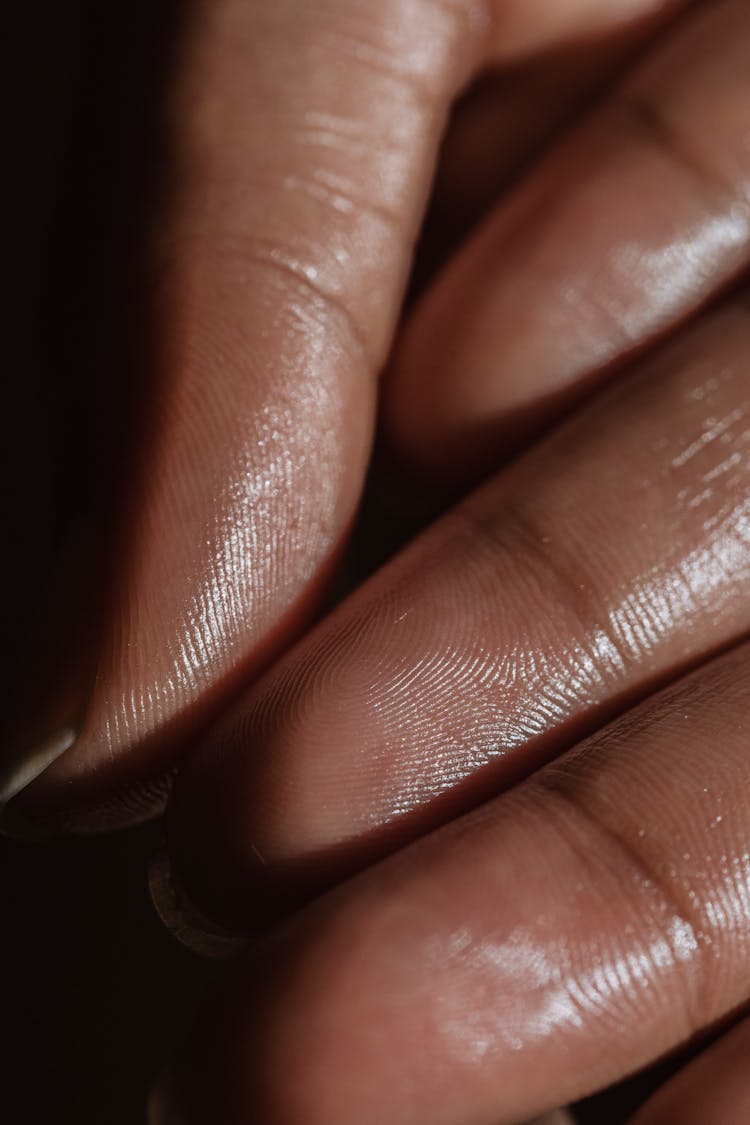 Fingers Of Crop Ethnic Model With Oily Skin