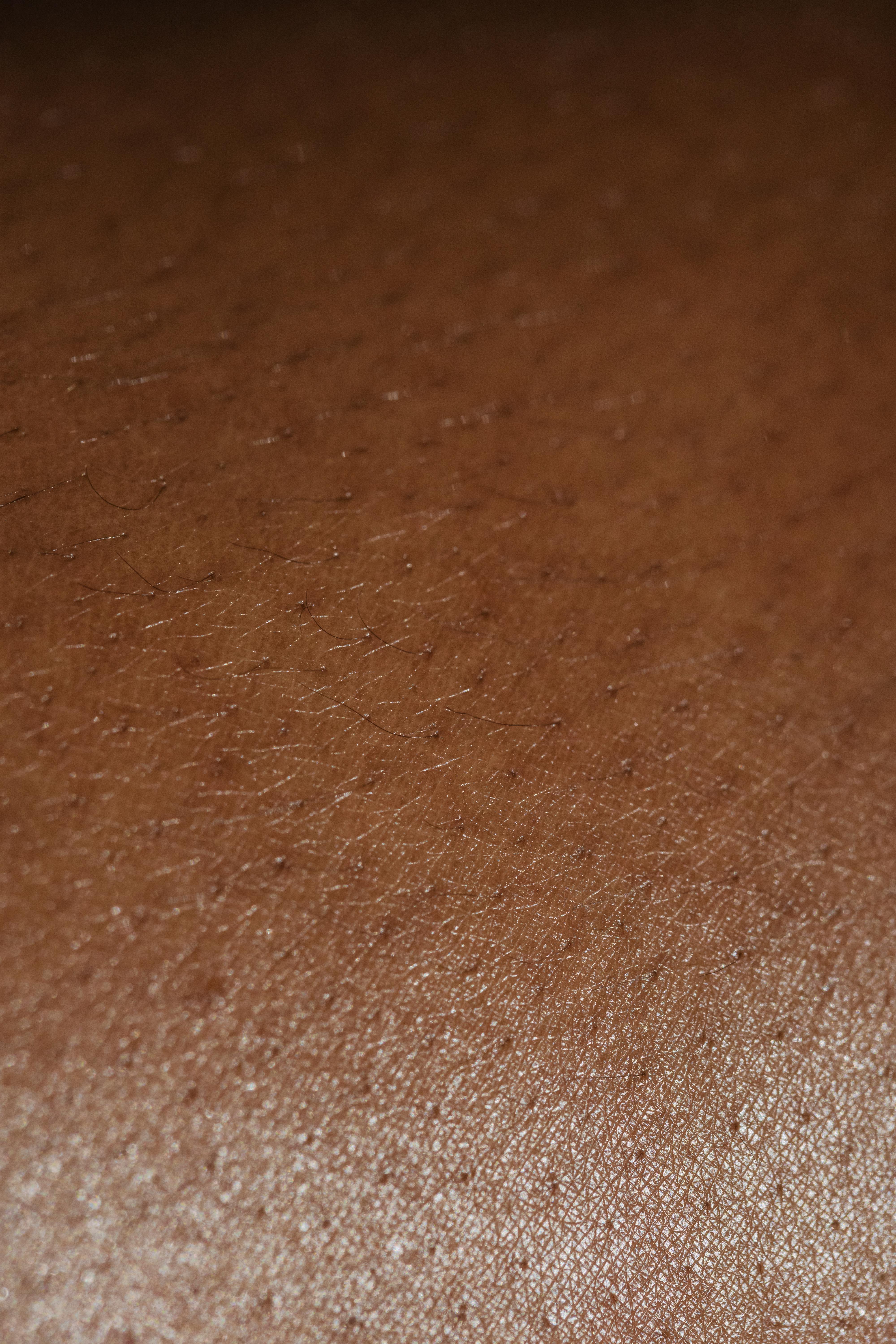 What do dermatologists recommend for dark spots?