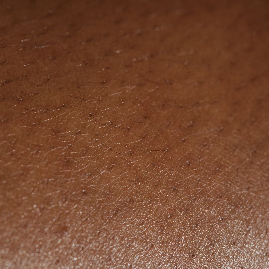 Digital Diagnostics and the Implementation of AI Skin Analysis in Personal Care Routines