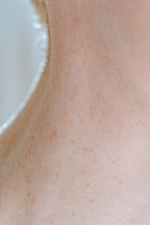 Closeup of neck skin of crop anonymous person with brown spots in daylight
