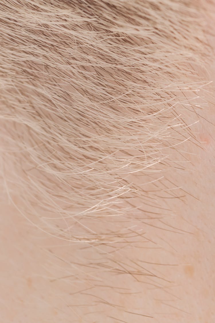 Skin With Brown And Fair Hairs