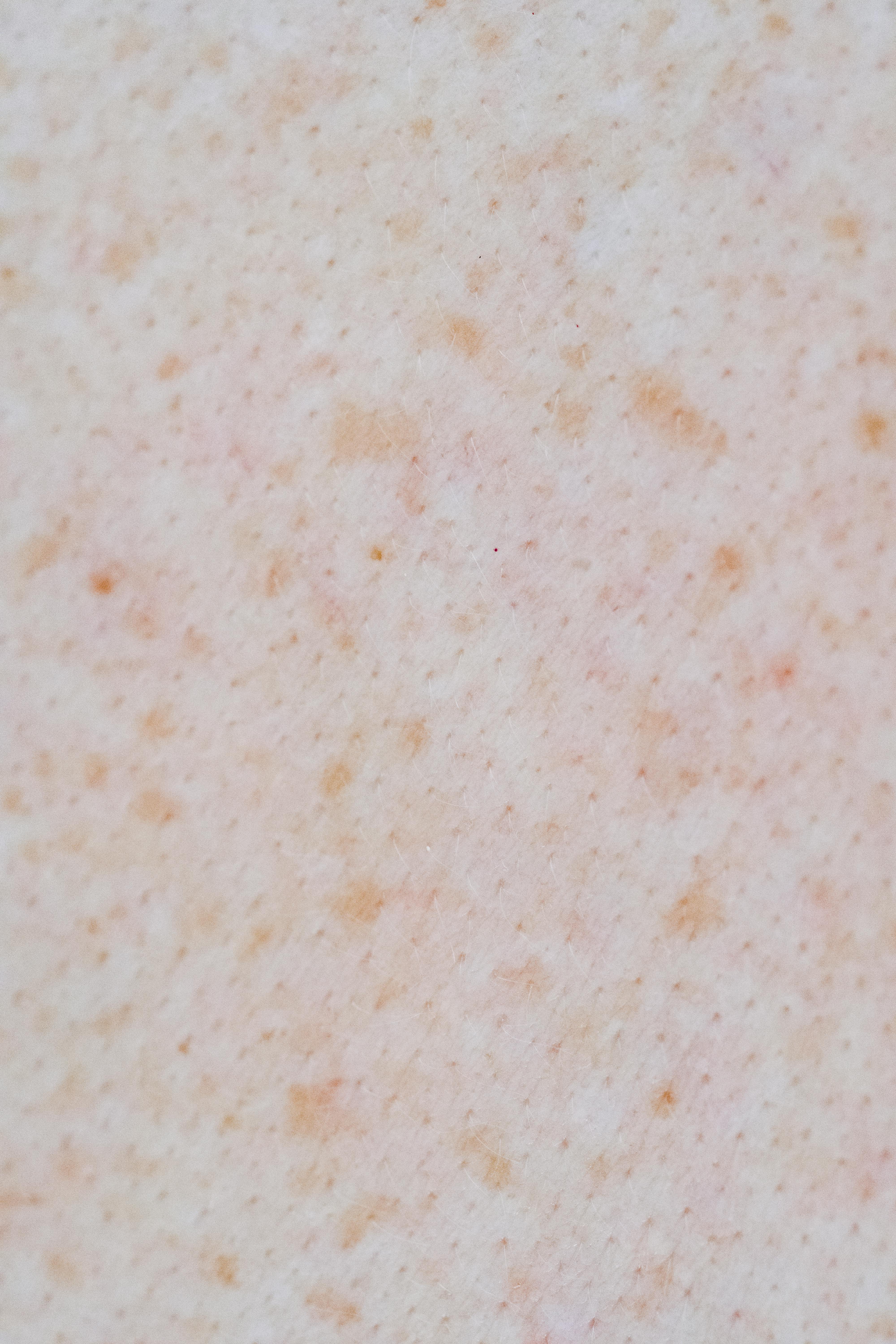 Photo by Angela Roma