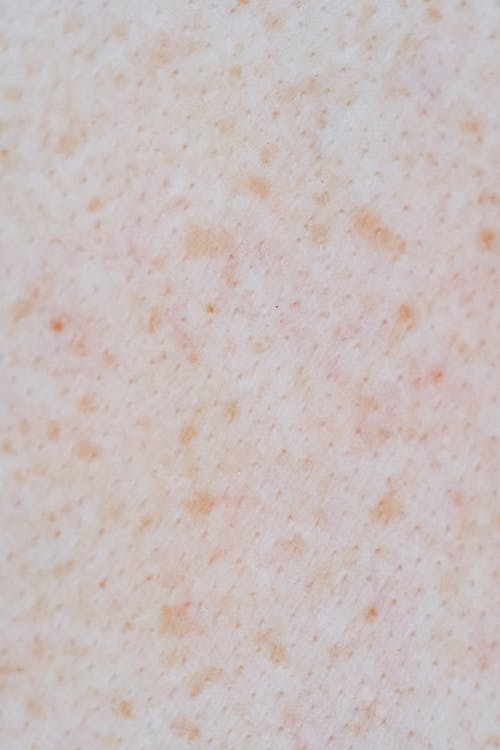 Full frame background of skin with brown spots and pores on textured surface