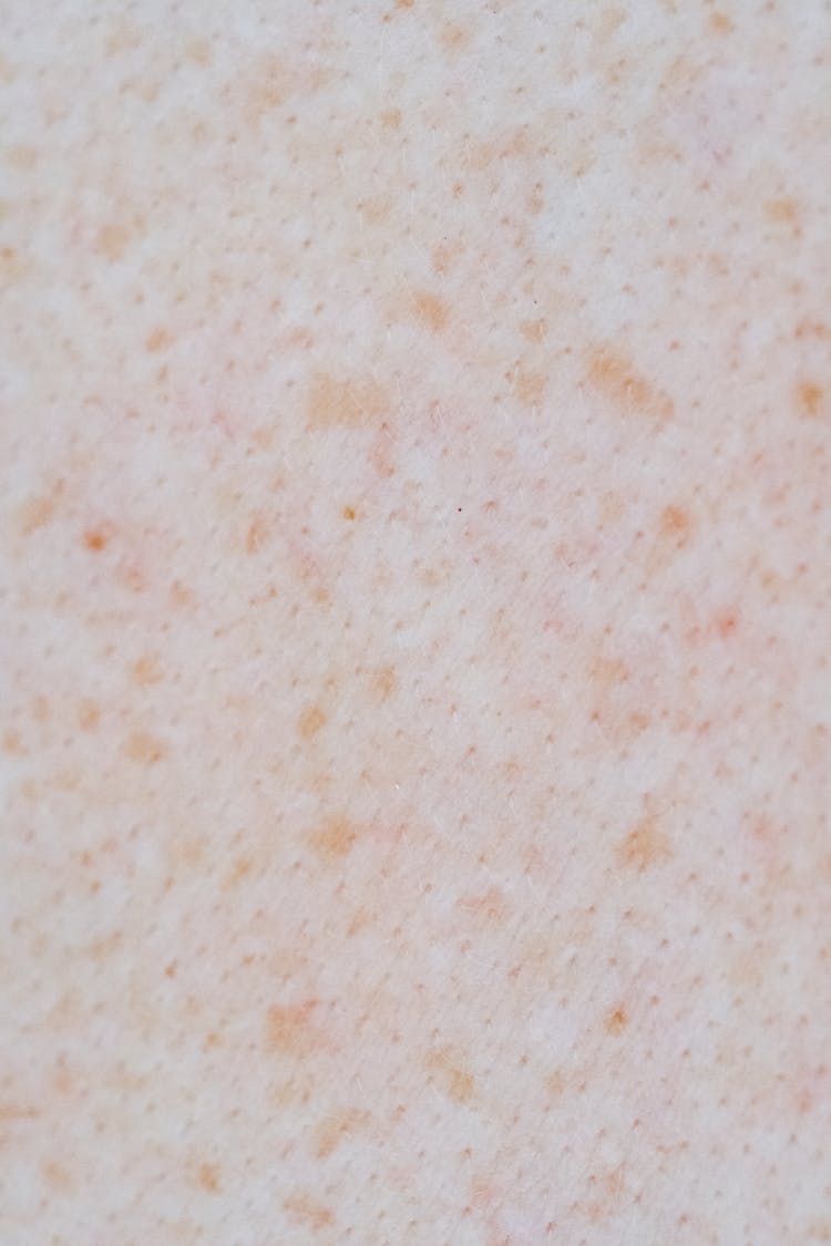Skin With Brown Spots And Pores