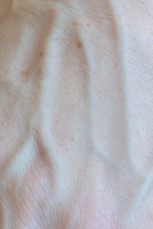 Closeup of superficial small veins bifurcating under surface of glossy skin in daylight