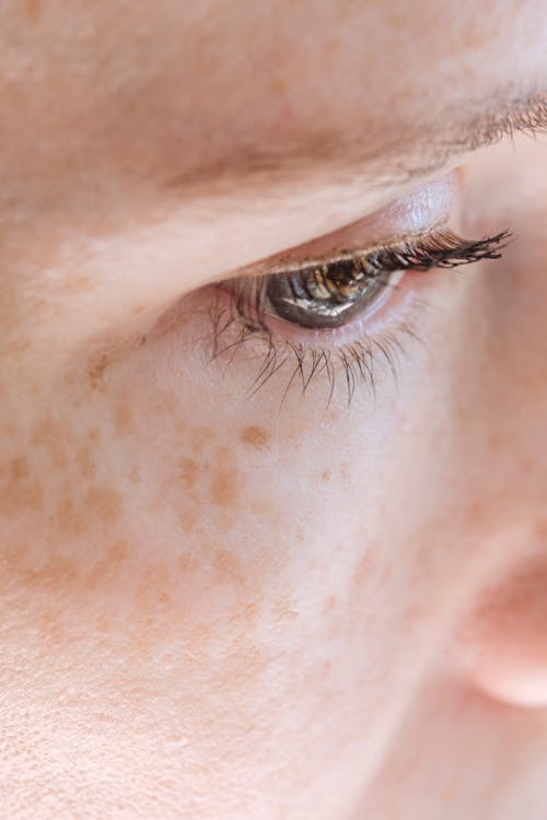 Closeup of crop female with freckles and blue eyes pensively looking away in daylight