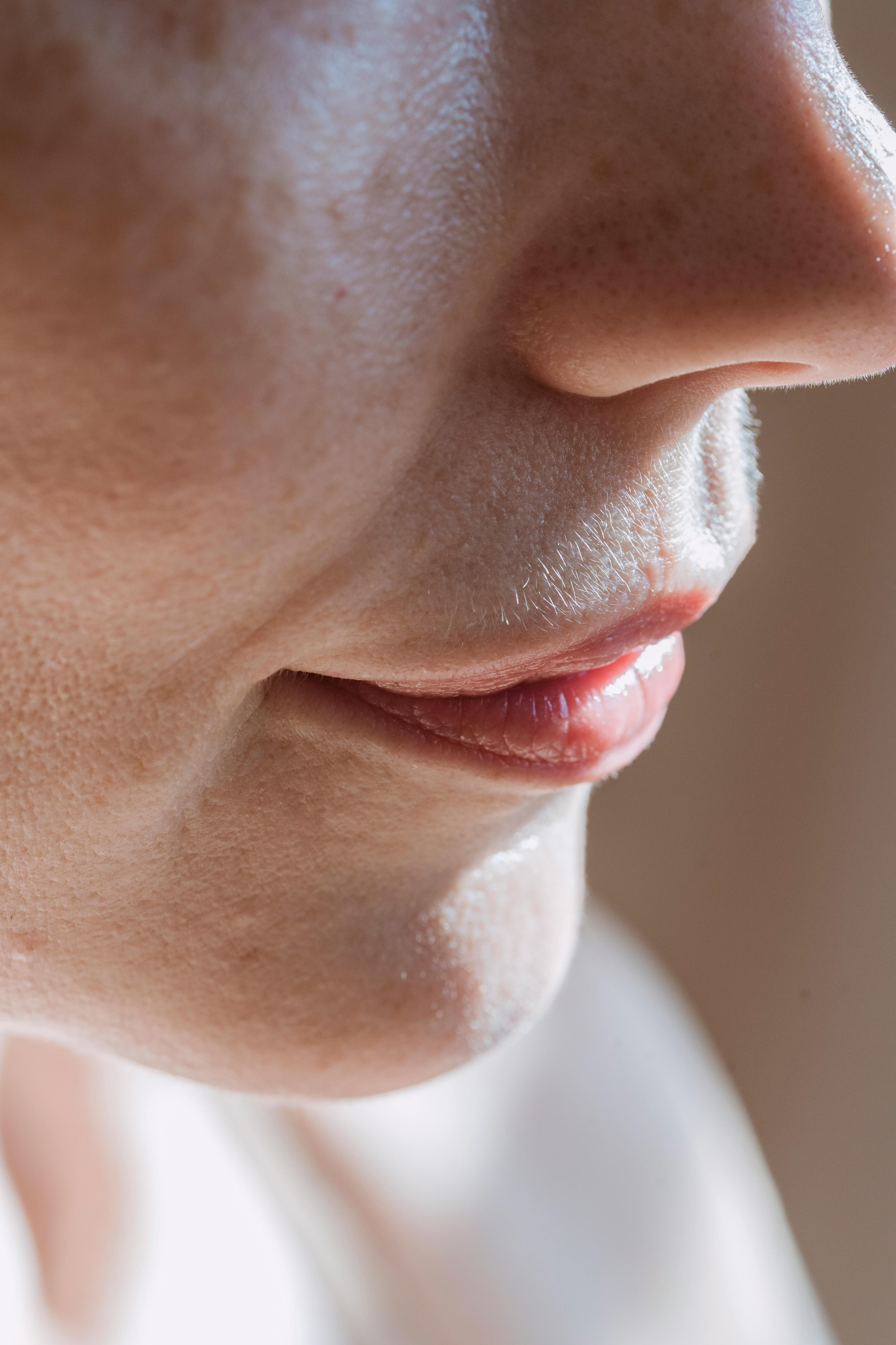 woman with freckles on face in sunlight