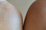 Crop unrecognizable person with freckles on body standing and touching shoulder of anonymous ethnic person against light wall in room