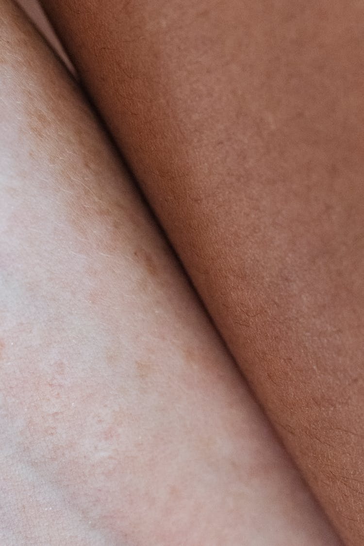 Contrast Skin Of Crop Diverse People