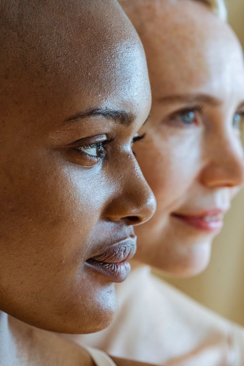 Free Side view of hairless African American female and blurred blond woman looking away Stock Photo
