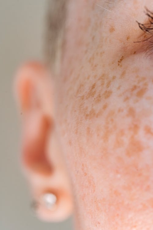 Free Crop face of female with freckles Stock Photo