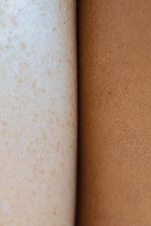 Skin surface of crop multiracial people