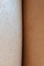 Skin surface of crop multiracial people