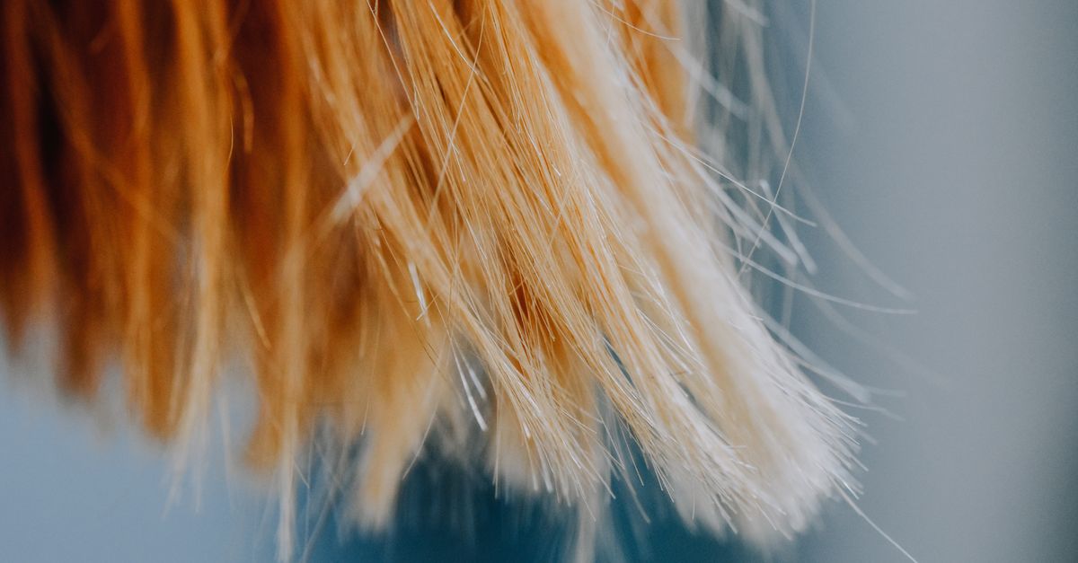 Is It Dandruff or Something More Serious?