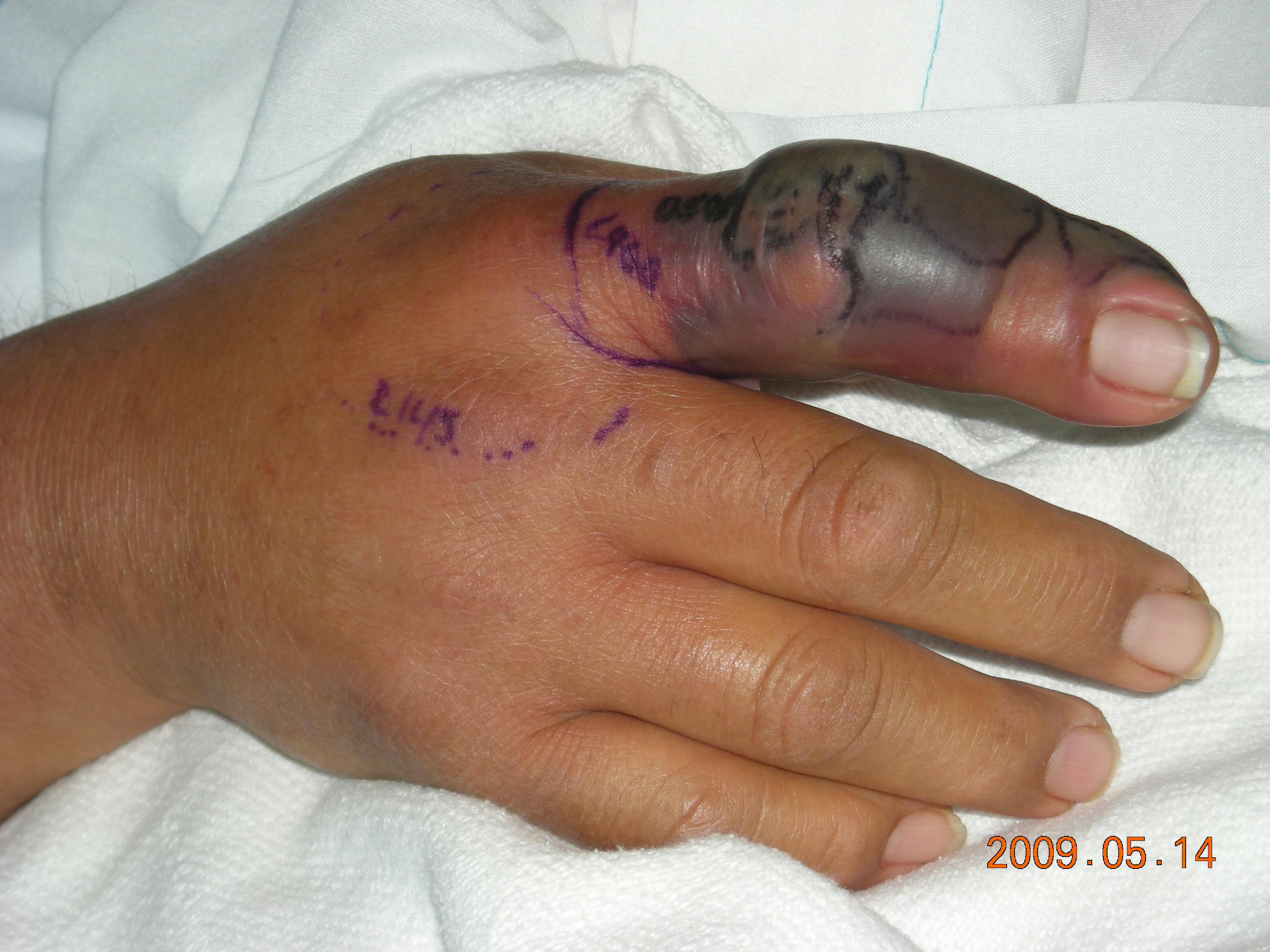 Chambre simple au Towns Well Motel