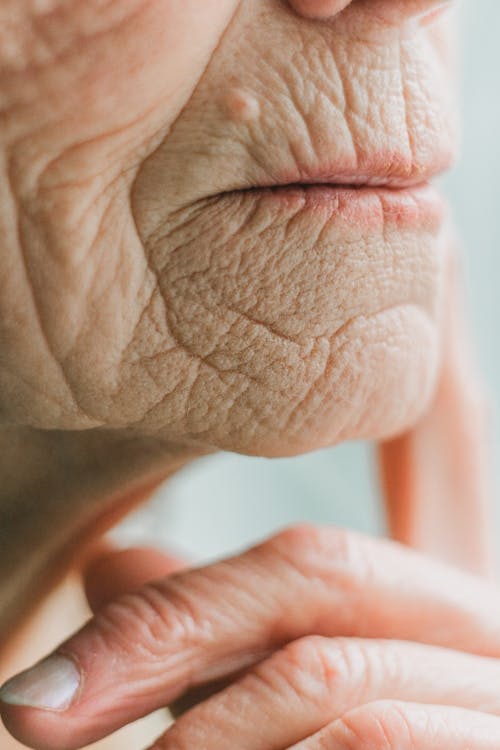 Extreme Close Up Photo of Wrinkled Skin 