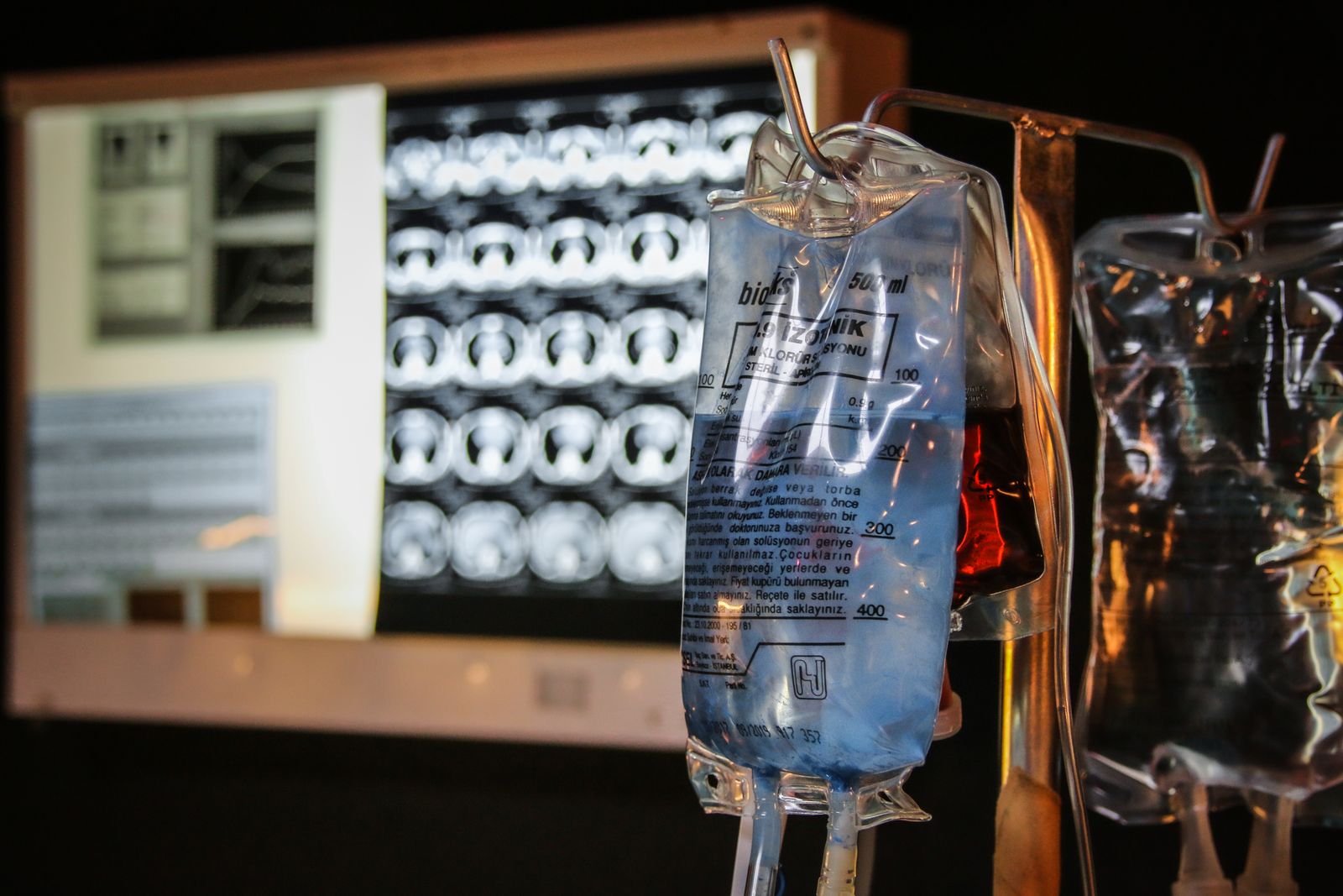 Retirada nacional de sueros intravenosos de bienestar a domicilio por riesgo de contaminación