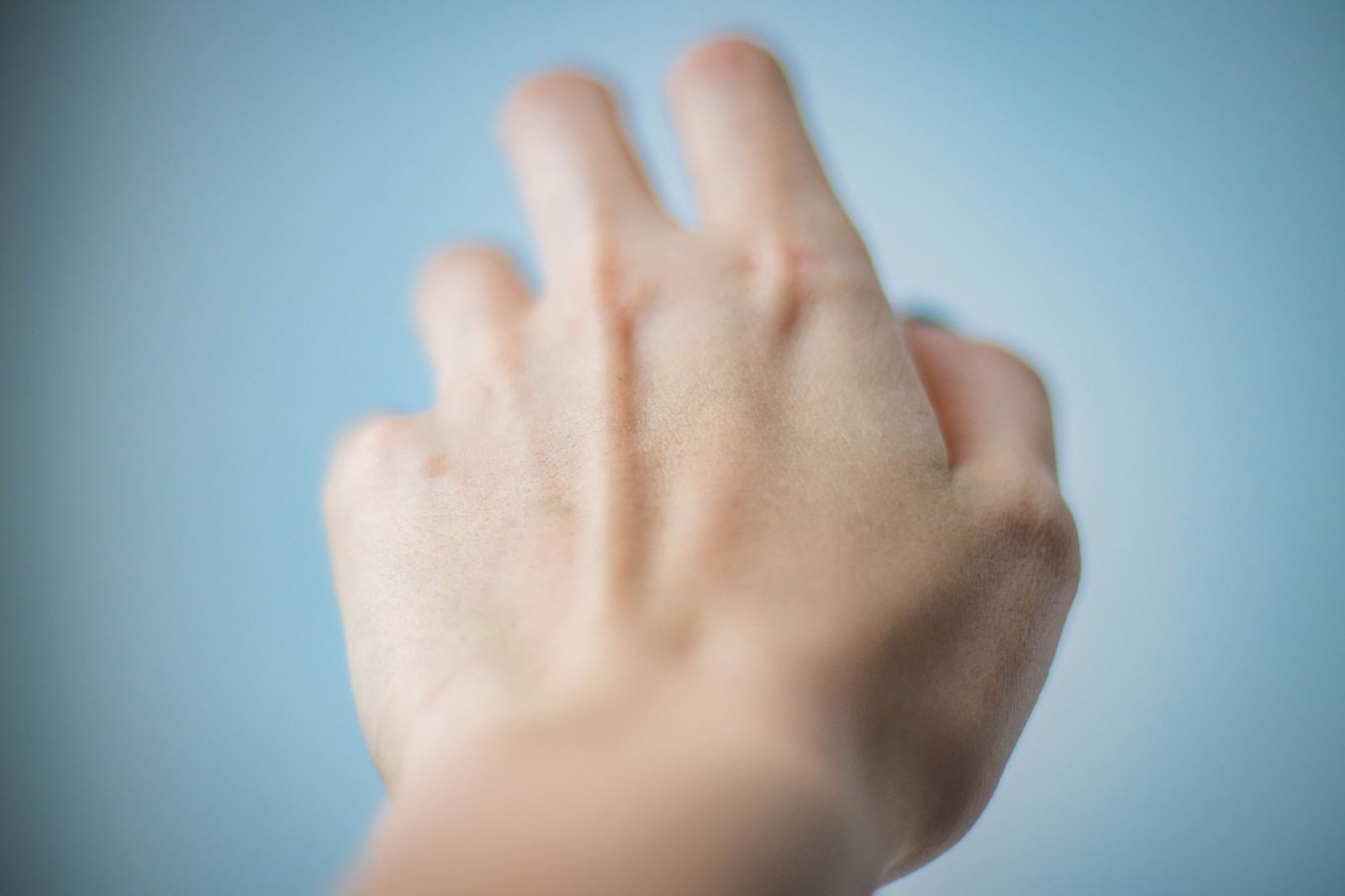 Bright close-up of a person gently holding their wrist and thumb outdoors