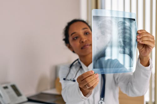 Doctor Looking at an X-ray Image of Lungs 
