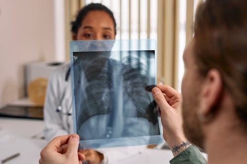 A Man Holding an X-Ray Result