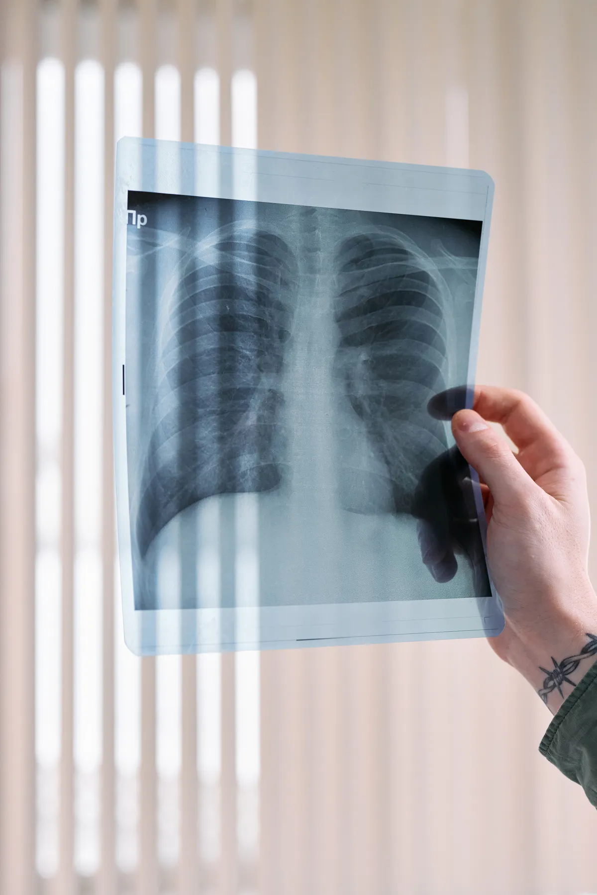 Why Does Lung Cancer Risk Persist After Quitting Smoking?