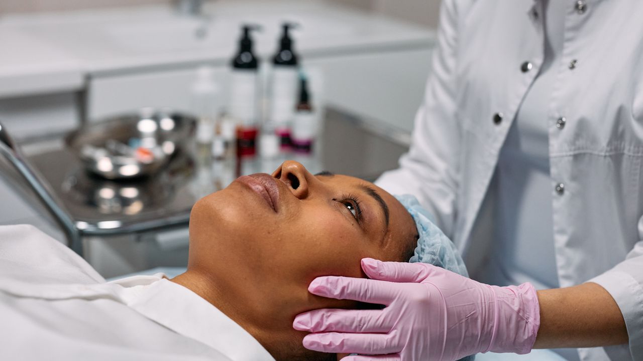 Preenchimento Bigode Chinês: Riscos, Segurança e Expertise em Jundiaí - Augusta Perfection
