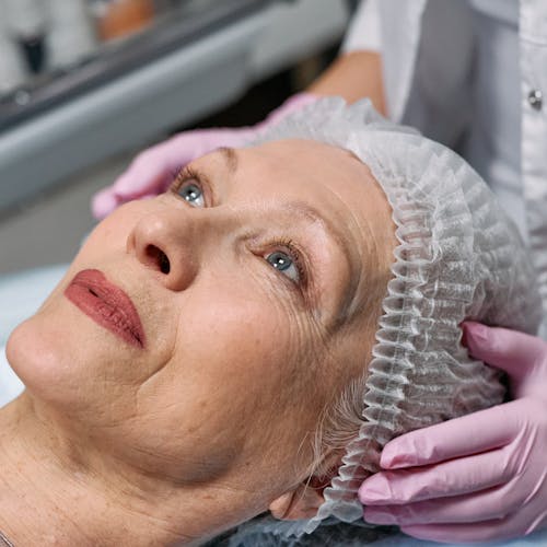 Facial Aesthetics - Saypha Dermal Fillers Treatment at Harleston Dental and Aesthetics Clinic
