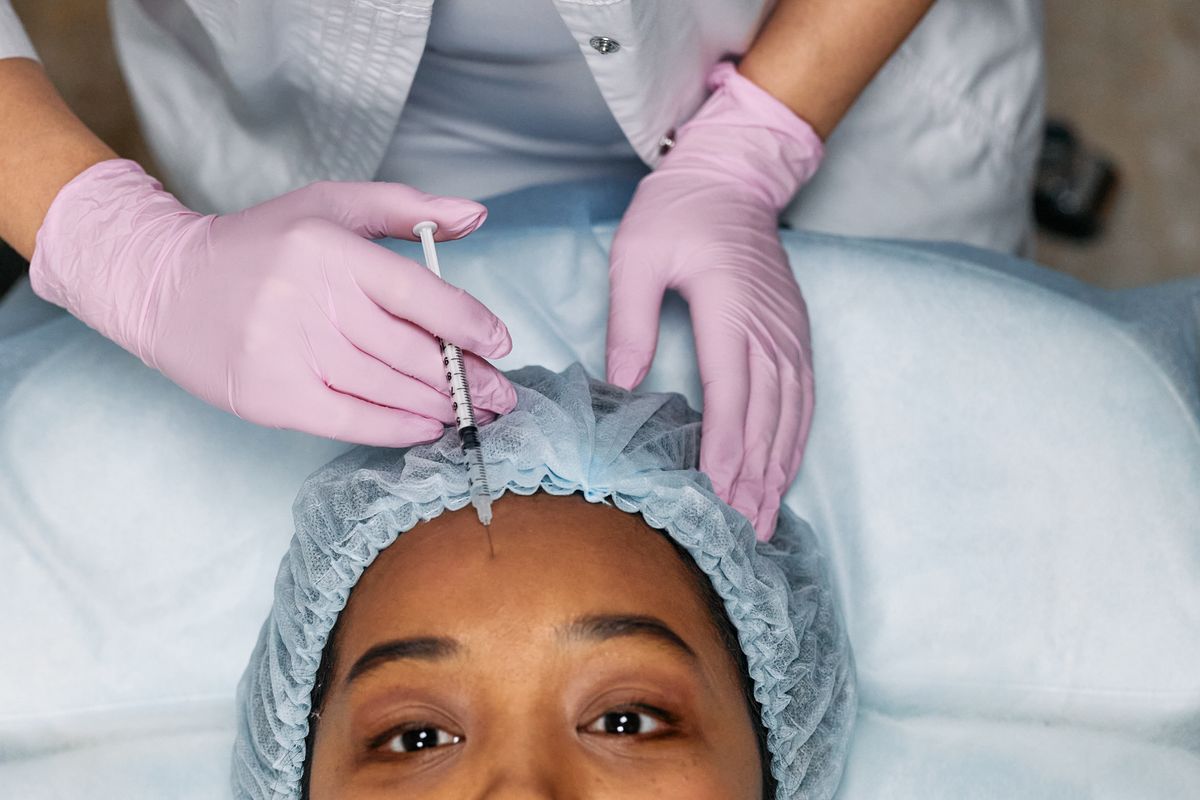 Imagem ilustrativa de aplicação estética na testa para Toxina Botulínica