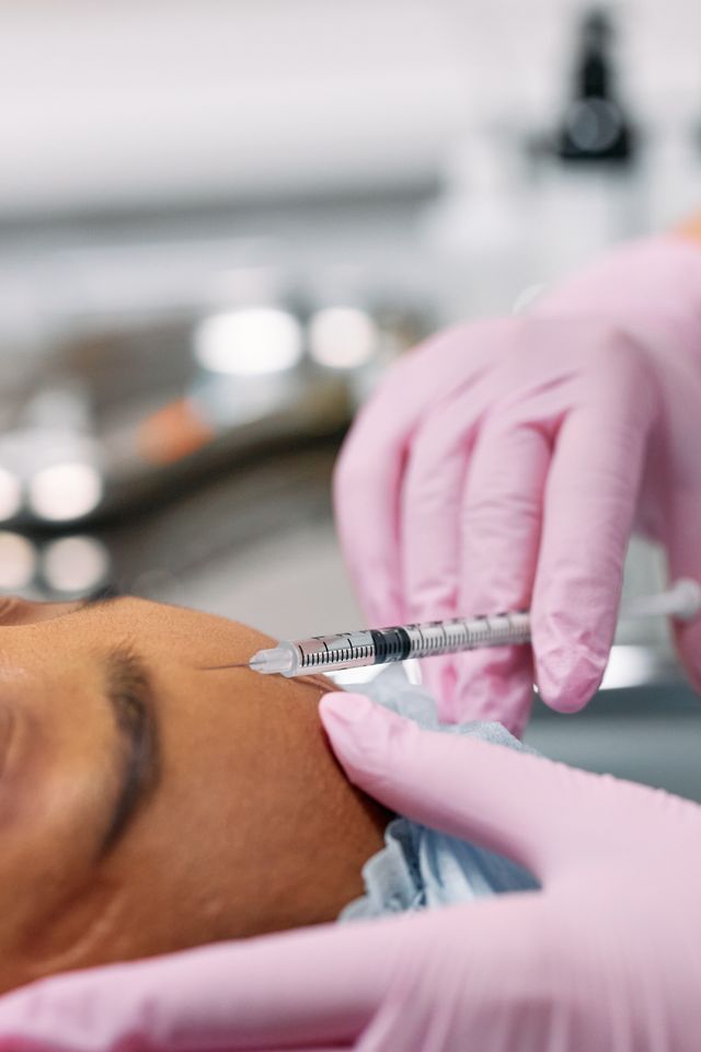 Precise dermal filler injection performed by a gloved provider