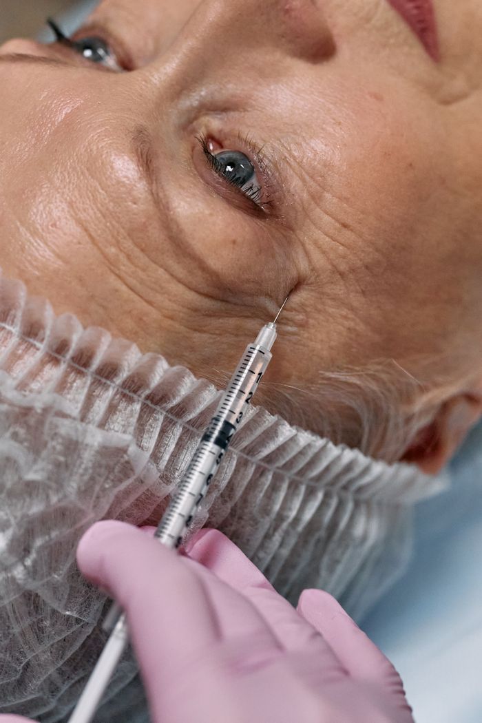 Procedimento de harmonização facial em clínica