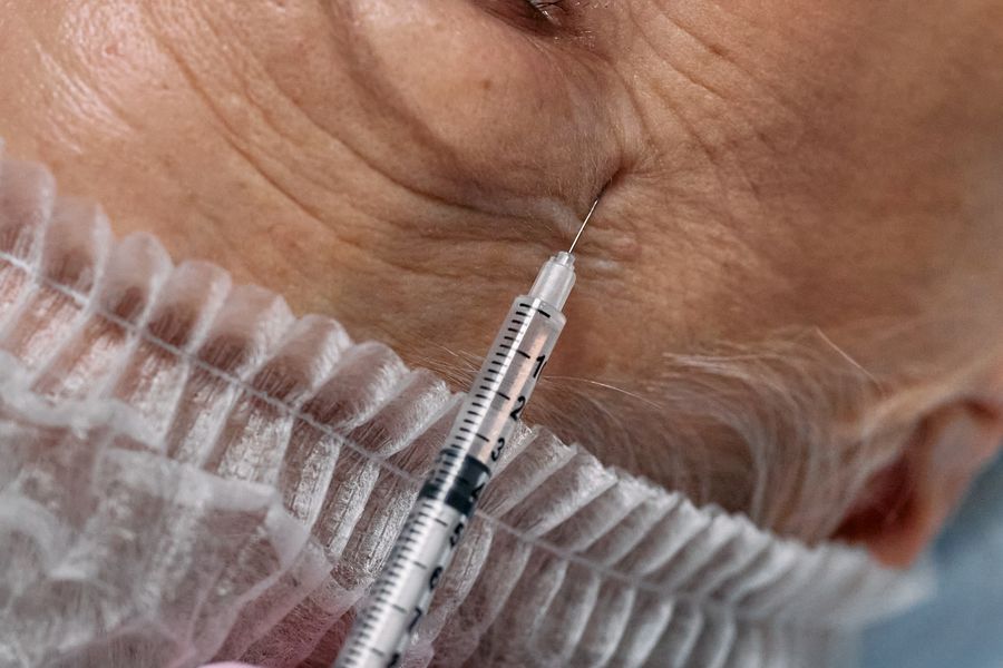 Mesoterapia Facial