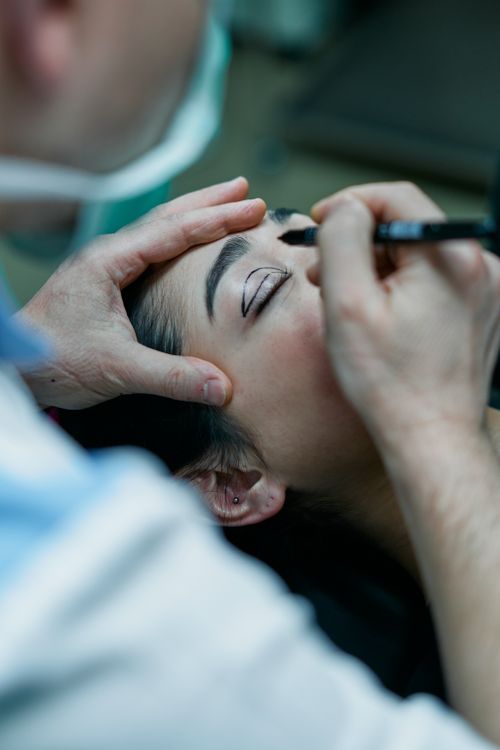 Surgeon marking a patient's eyelid before blepharoplasty surgery