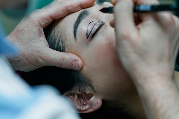 Blepharoplasty (Eyelid Surgery)