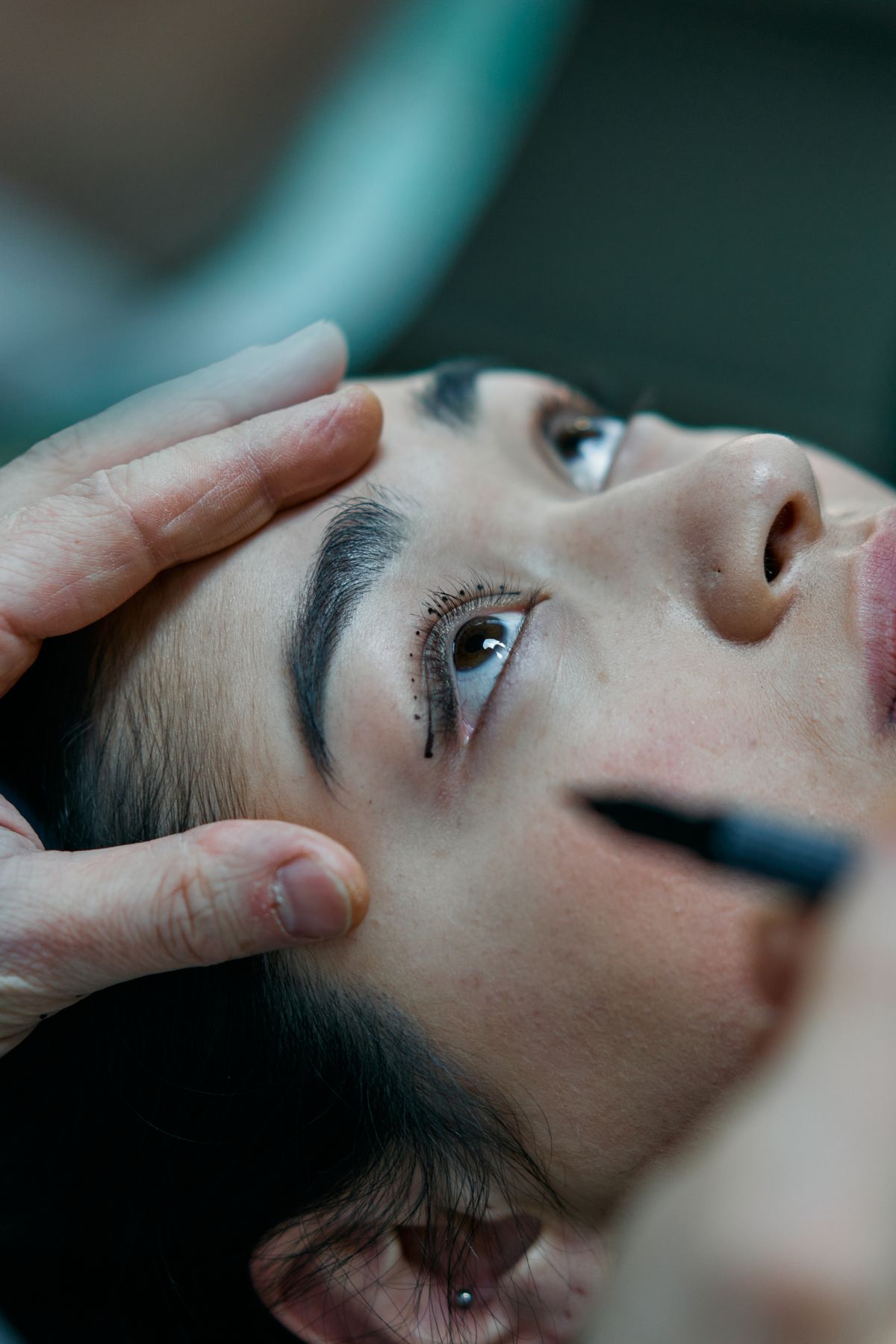 Patient undergoing final review of upper- and lower-eyelid markings before surgery