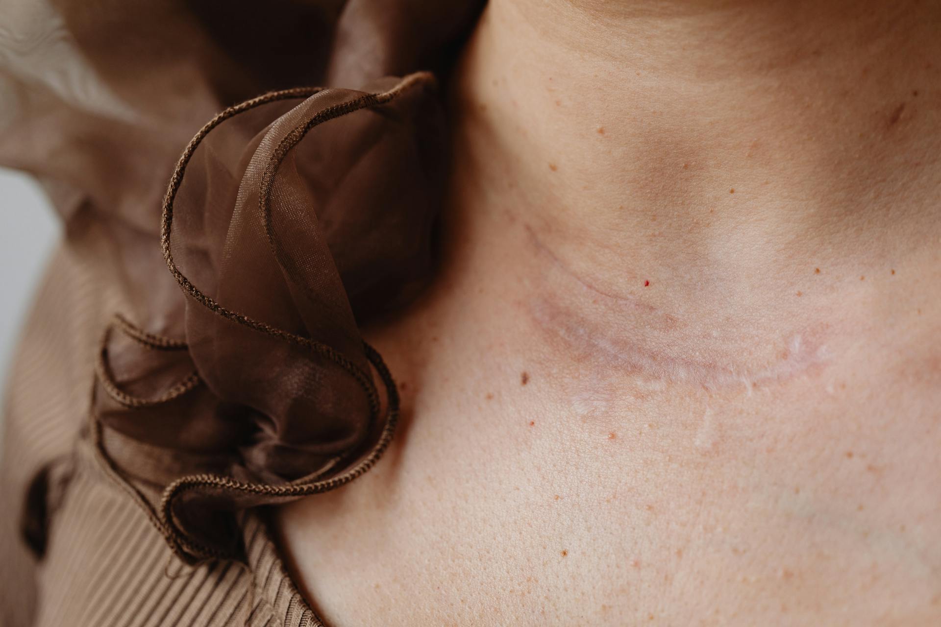 Close up of a Scar on a Neck