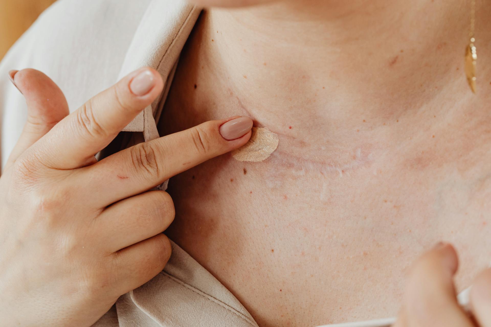 A Person Applying Concealer on a Scar