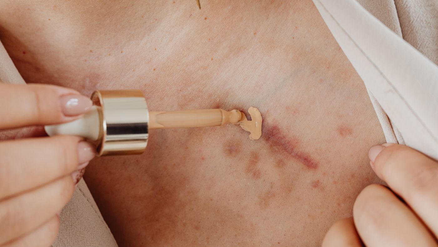 Are Cosmetics Helping or Hurting Your Skin? An Honest Look