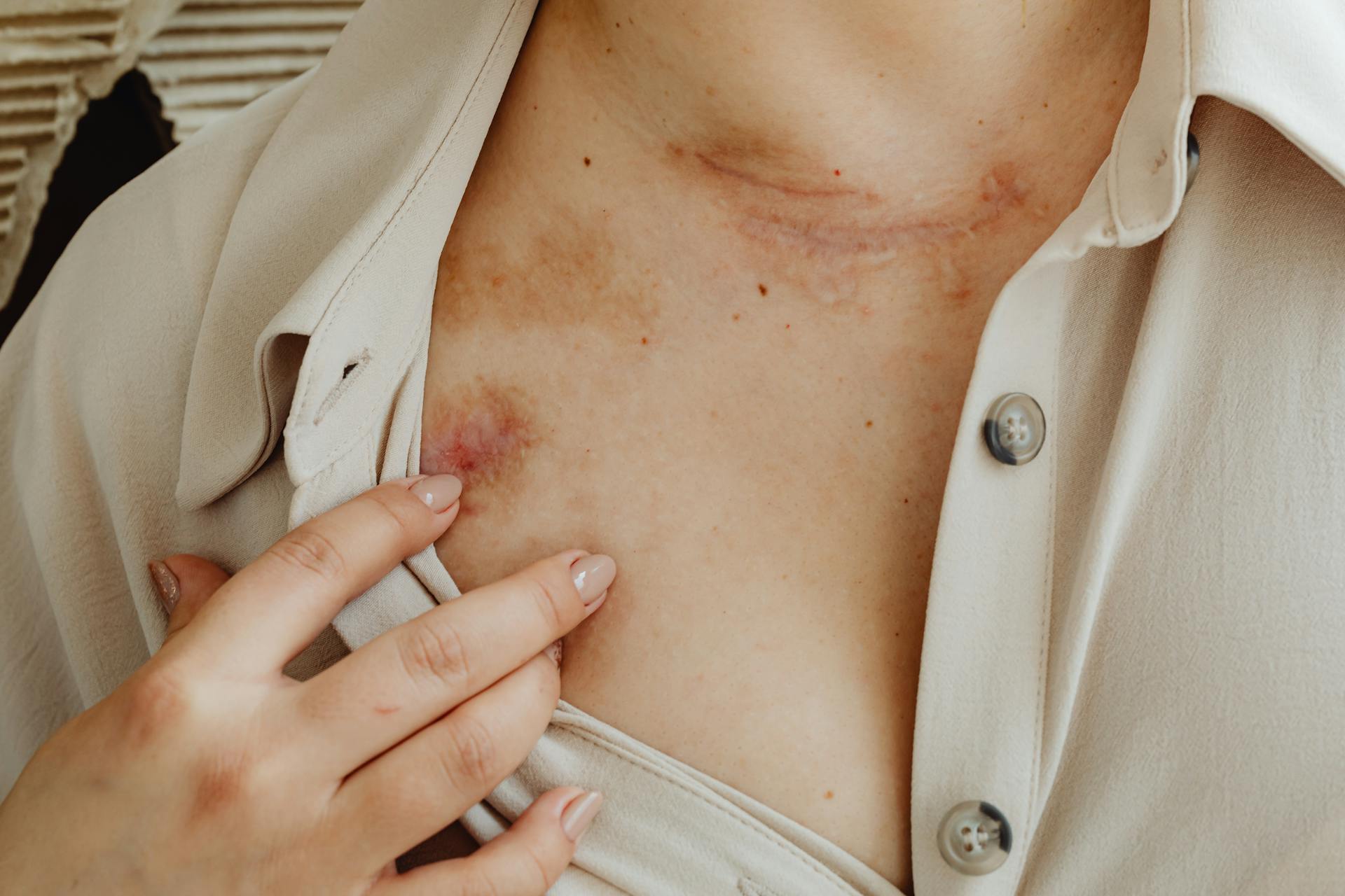 Woman with Scars on her Skin