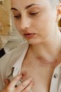 A Woman with Scars on Neck