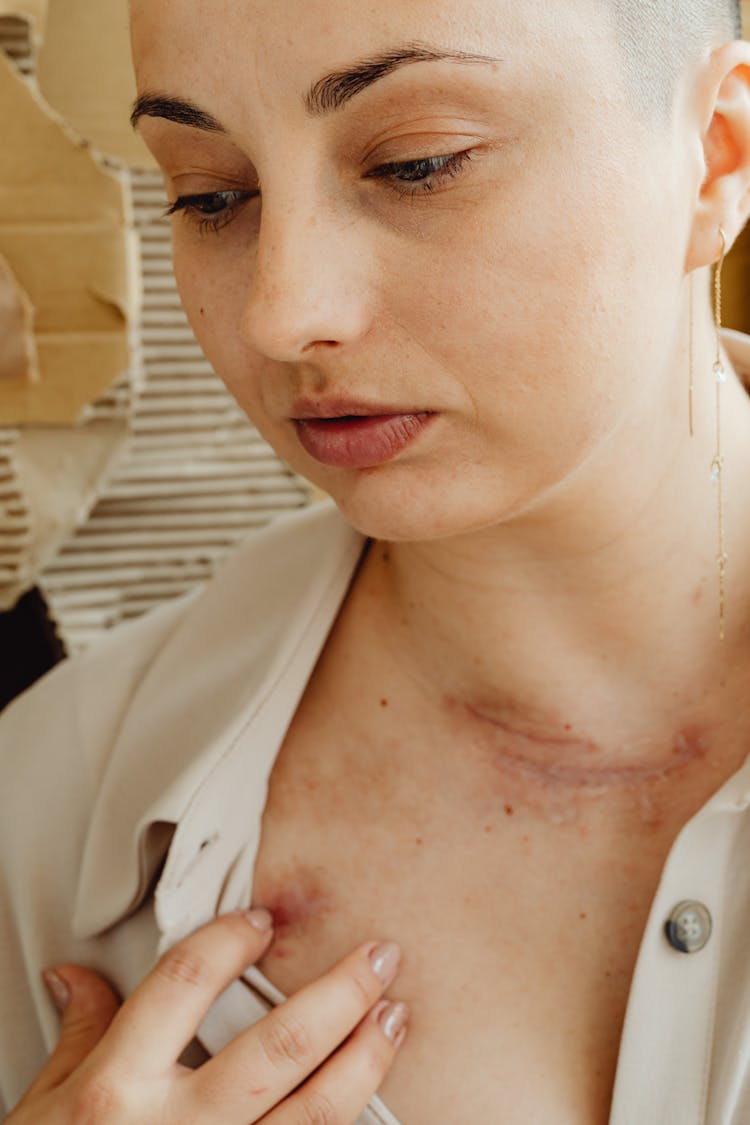 A Woman With Scars On Neck