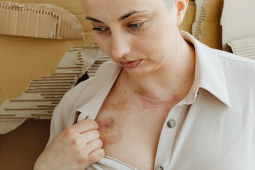 Woman Showing Scars and Bruises