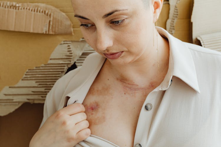 Woman Showing Scars And Bruises