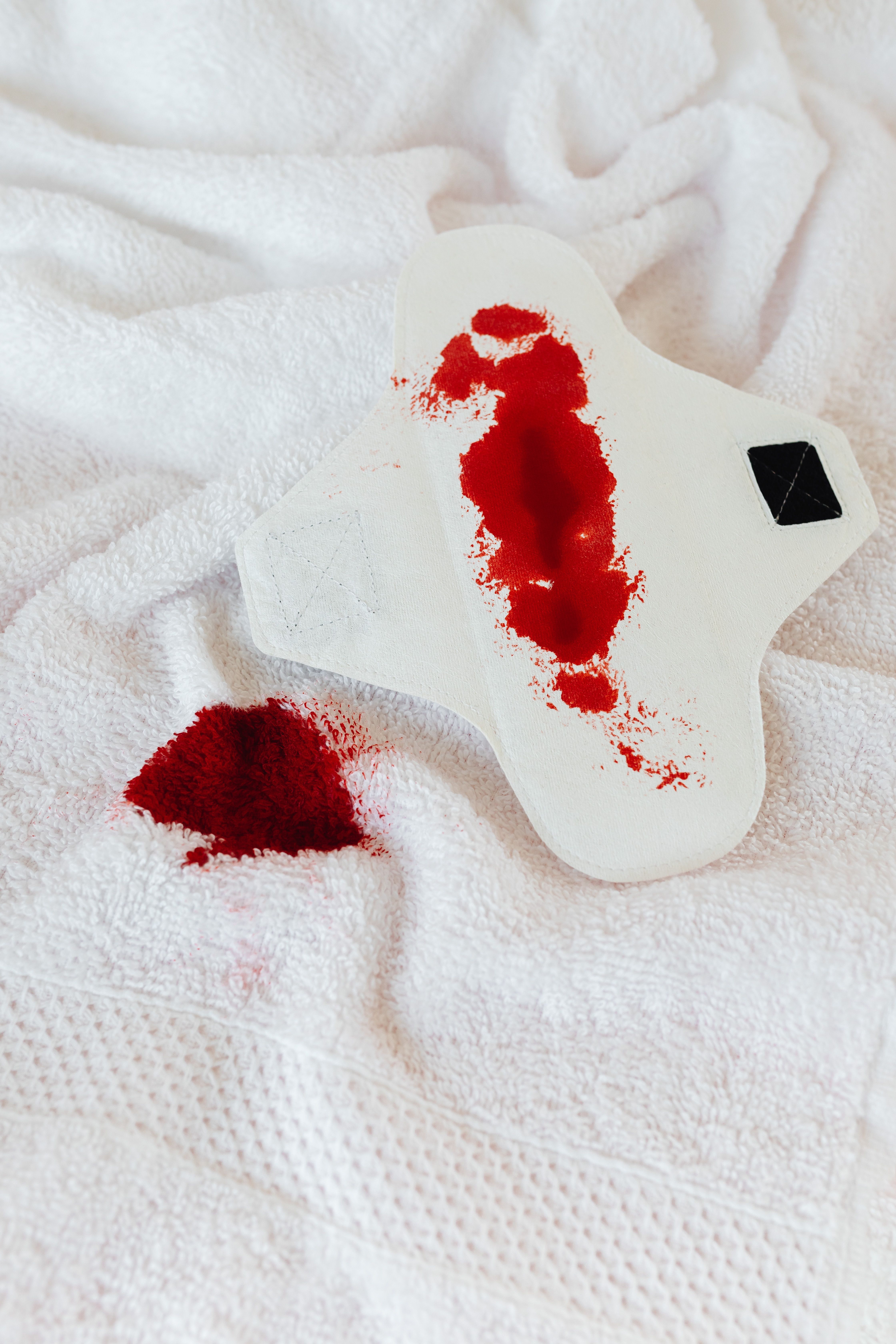 Close-up of sanitary pad and bloodstain on white towel, symbolizing menstruation and feminine care.