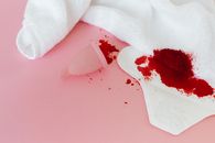 Blood on a Sanitary Napkin