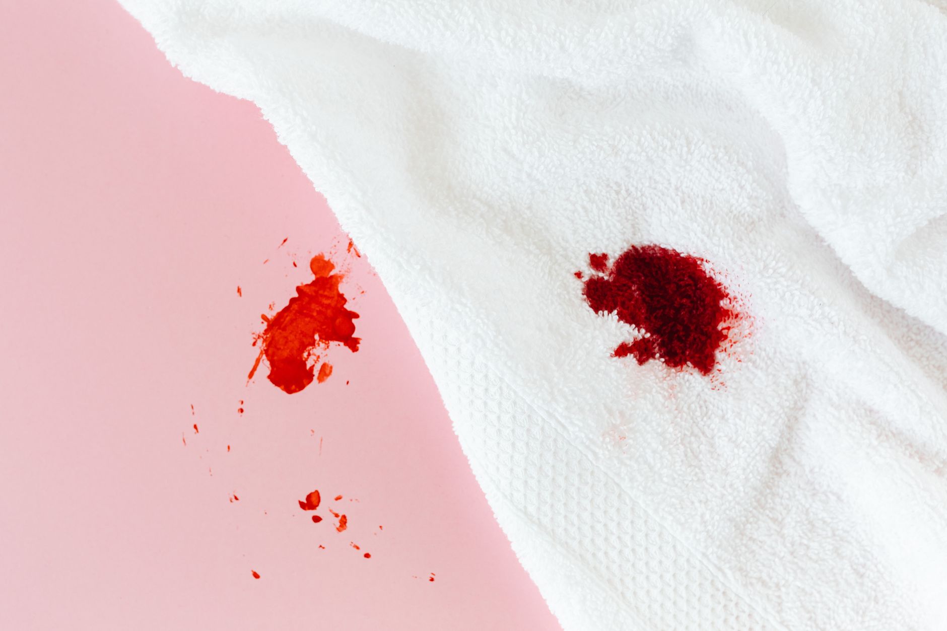 Spotting vs. Period: Understanding the Differences and Causes